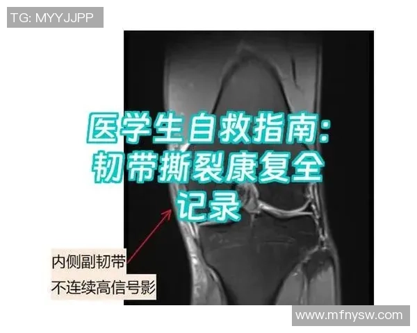 打篮球时不慎扭伤膝盖如何科学处理与康复指南